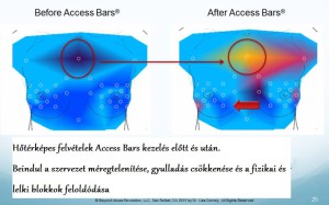 Access_Bars_hatása_hőtérképes_felvétel